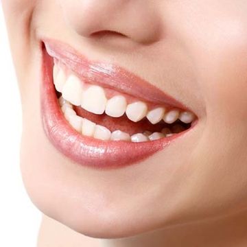 Odontoiatria estetica